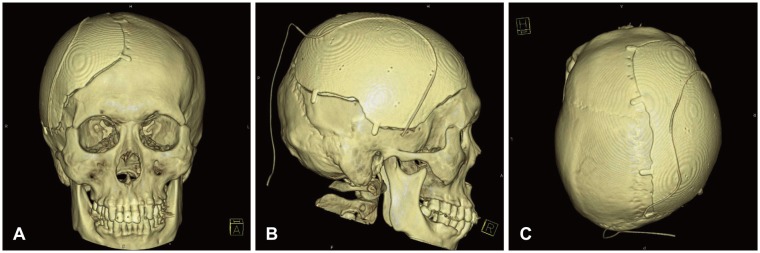 FIGURE 1