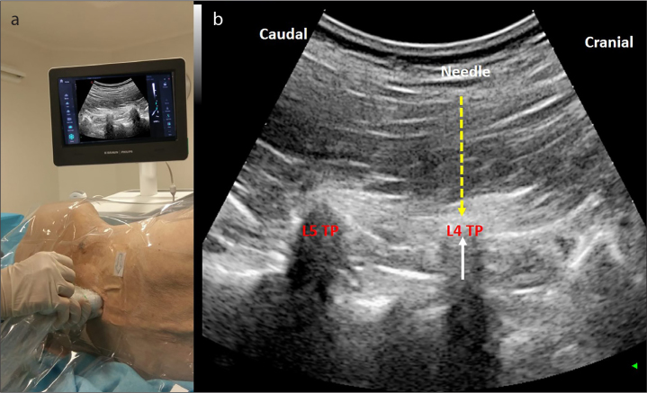 Figure 1. a, b