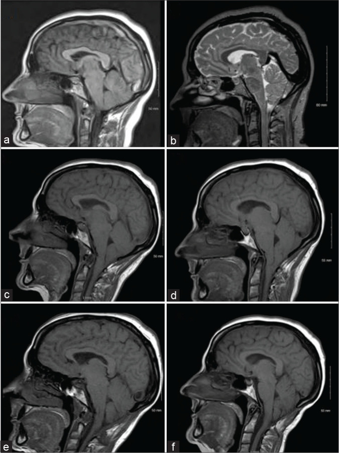 Figure 1: