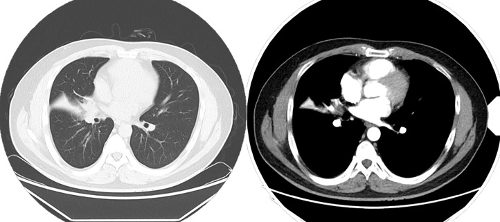 Figure 4