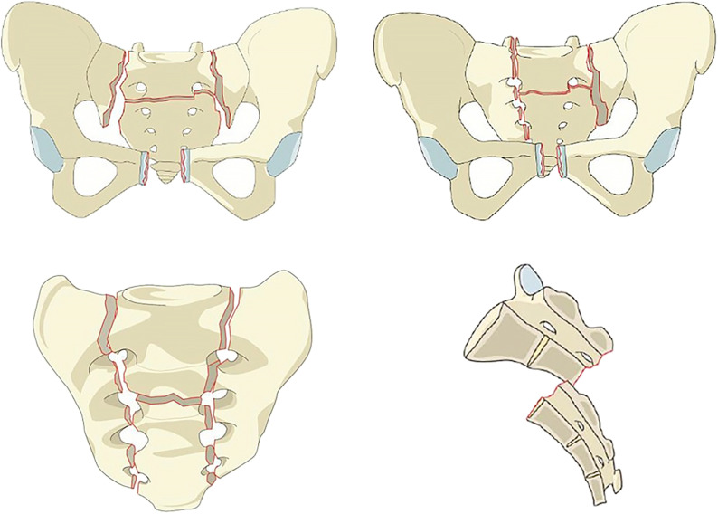 Fig. 10