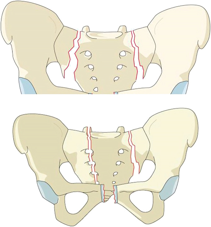 Fig. 9