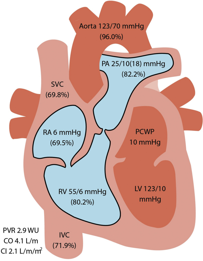 Figure 2