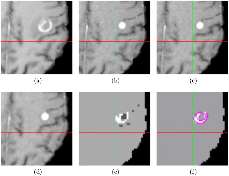 Fig. 2: