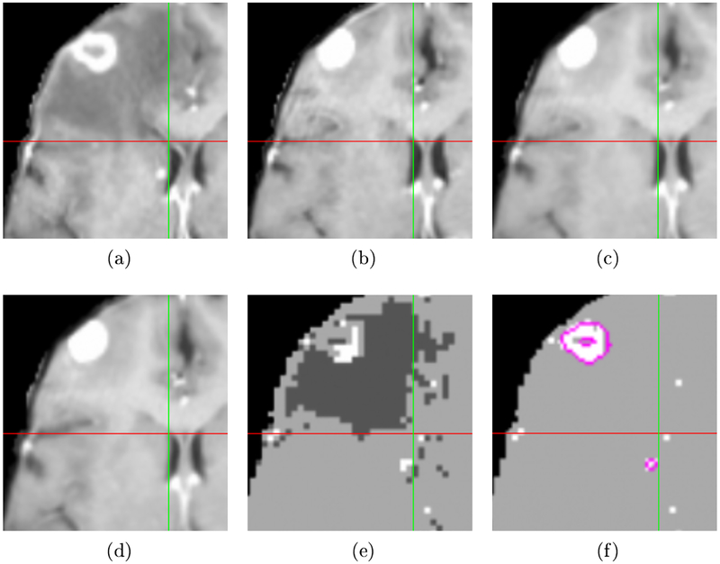 Fig. 1: