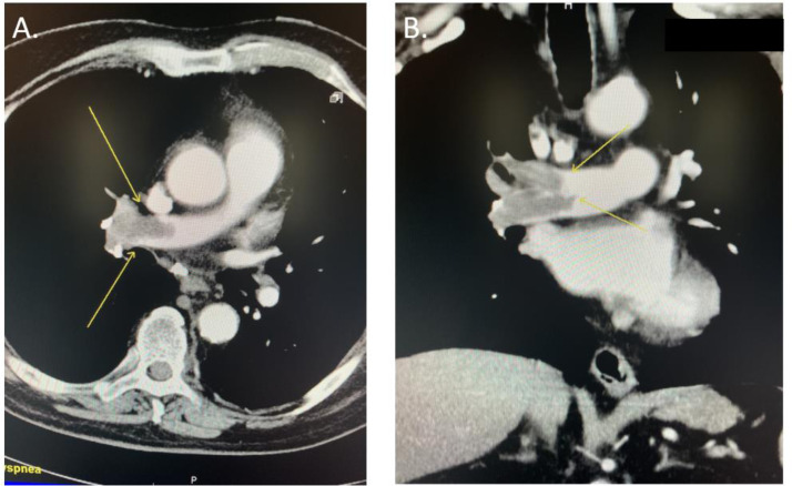 Fig 1 –