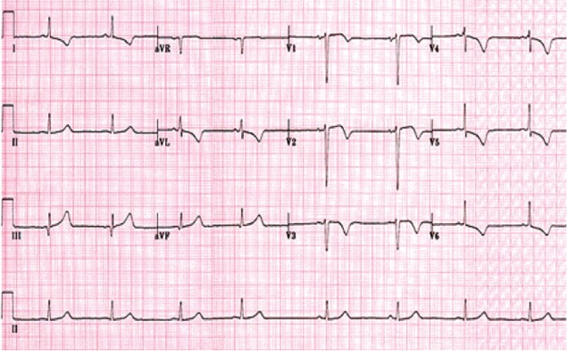 Fig 3.