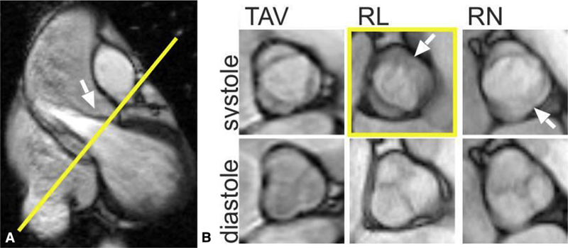 FIGURE 13.