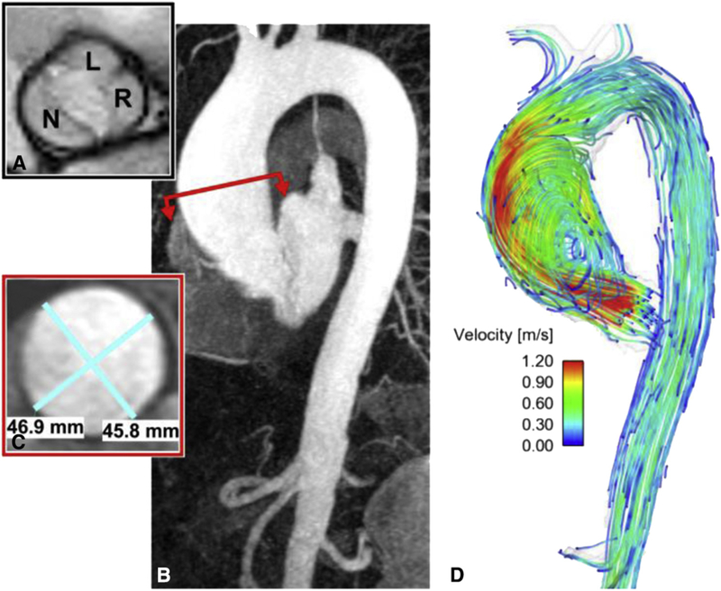 FIGURE 14.