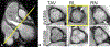 FIGURE 13.