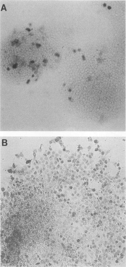 graphic file with name molcellb00077-0214-a.jpg