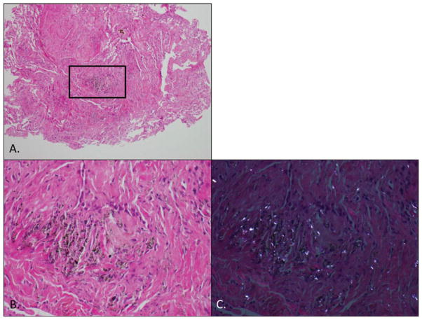 FIGURE 1