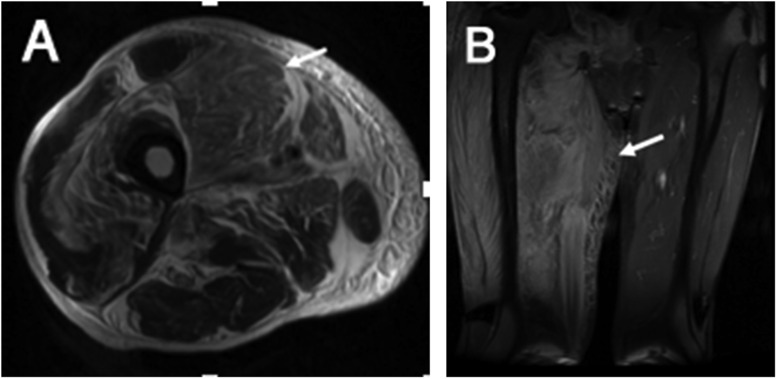 Figure 13.