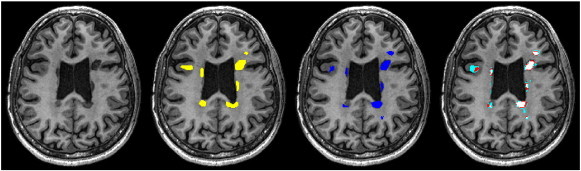 Fig. 2