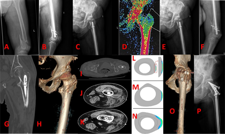 Fig. 4