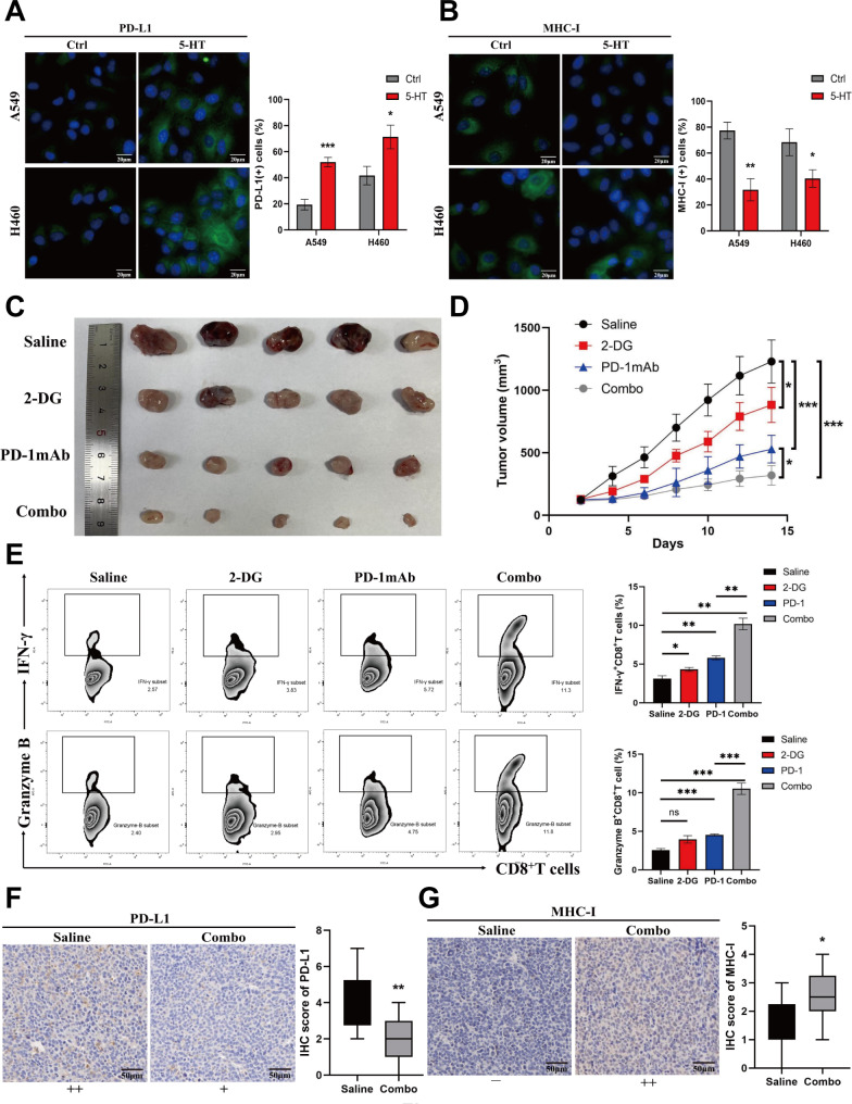 Mechanisms of neural infiltration mediated tumor metabolic