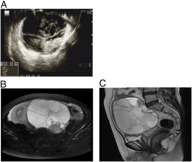 Fig. 1