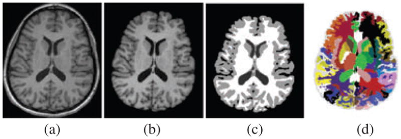 Fig. 1