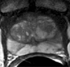 Figure 2a: