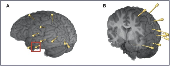 FIGURE 3