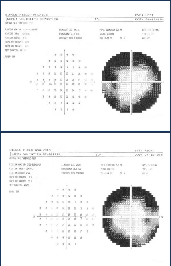 Fig. 4,5