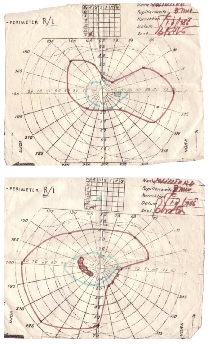 Fig. 2,3