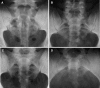 Fig. 2