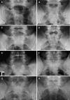 Fig. 1