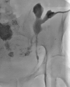 FIG. 3.