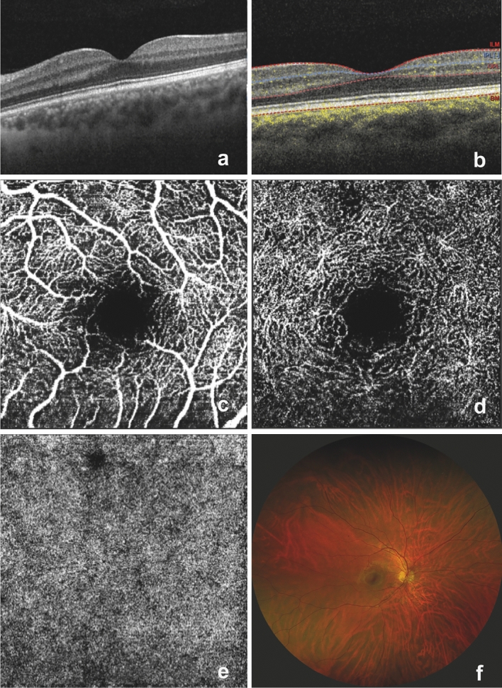 Fig. 1