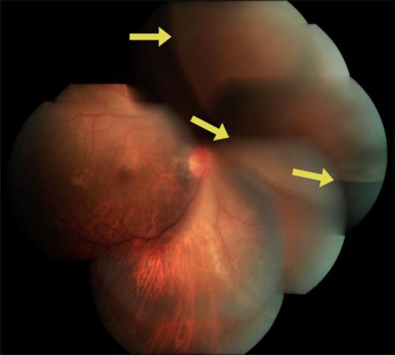 Fig. 1