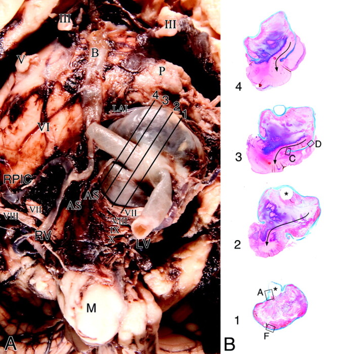 Fig 5.