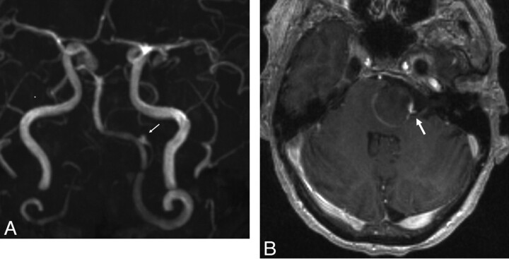 Fig 3.