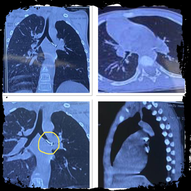 Fig. 5