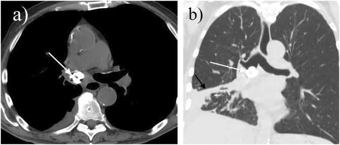 Fig. 1.