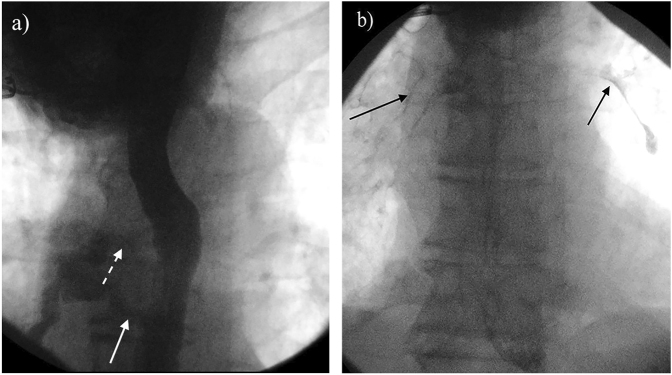 Fig. 2.