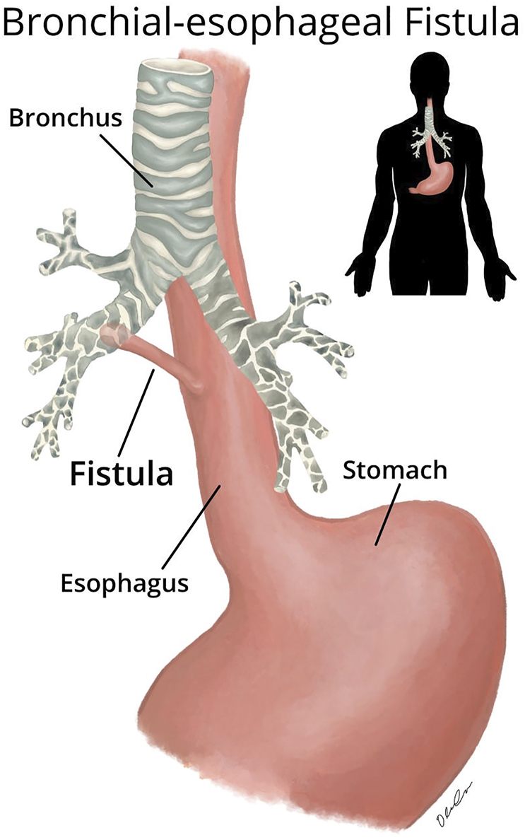 Fig. 4.