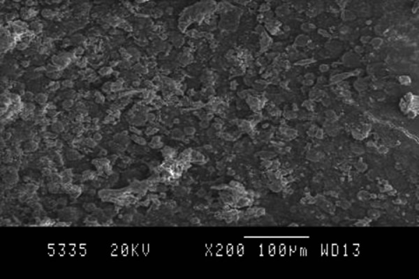 Photograph 5: Photomicrograph Showing Debris-Score 5