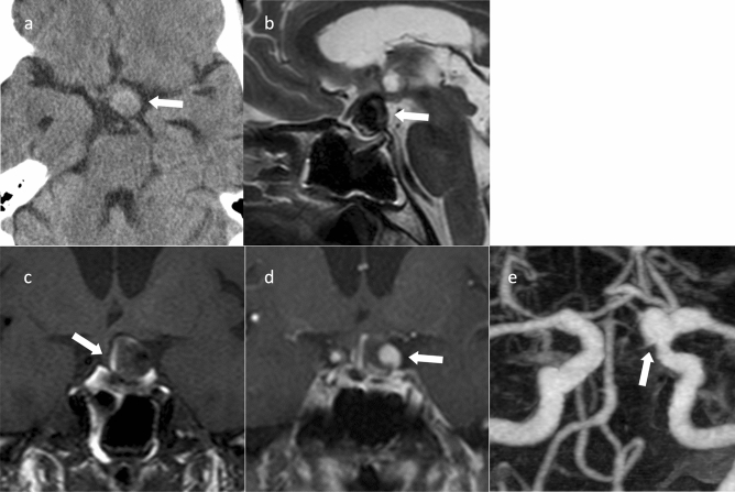 Fig. 13