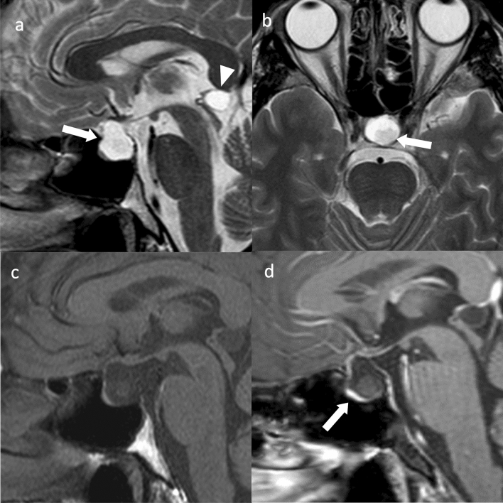 Fig. 11