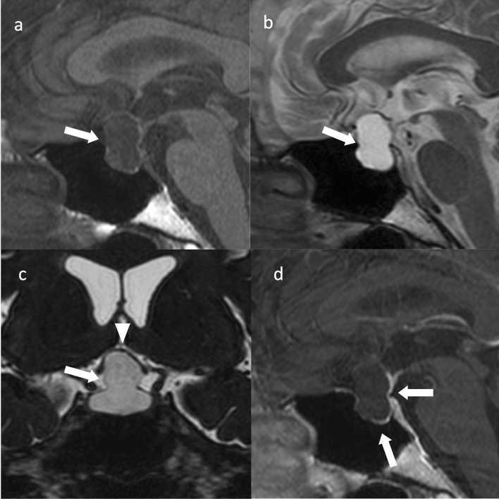 Fig. 12