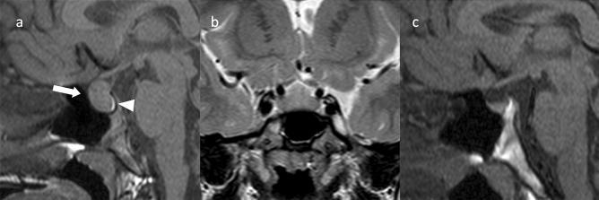 Fig. 10