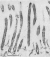 112