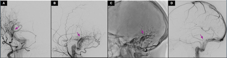 Fig 4