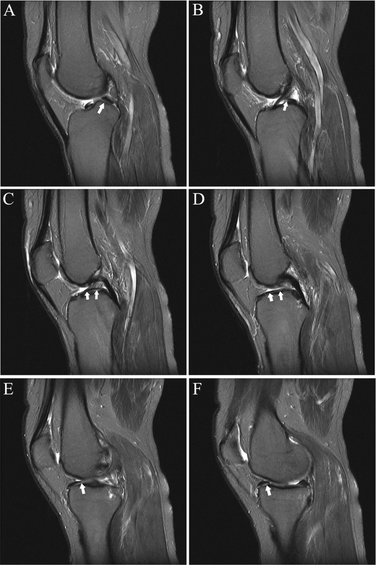 Figure 18.