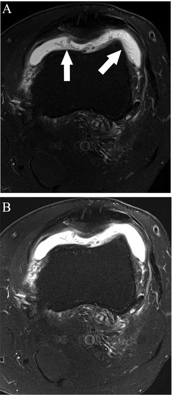 Figure 35.