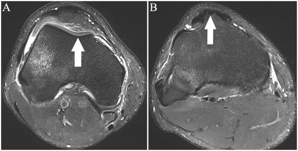 Figure 28.