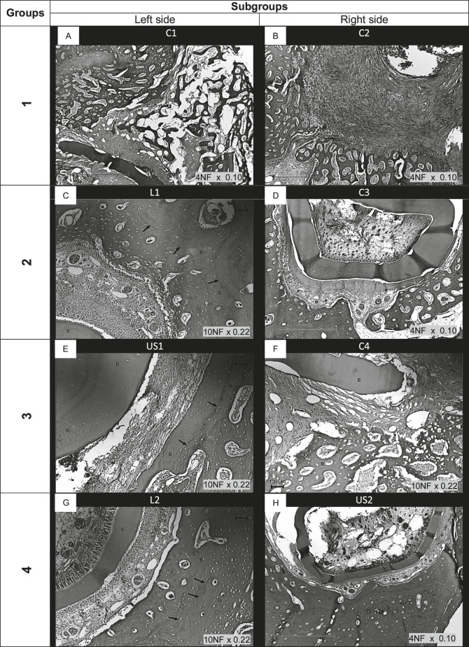 Figure 3. Photomicrographs of subgroups: (A) C1  =  control 1; (B) C2  =  control 2; (C) L1  =  laser 1; (D) C3  =  control 3; (E) U1  =  ultrasound 1; (F) C4  =  control 4; (G) L2  =  laser 2; (H) US2  =  ultrasound 2. Legends: C  =  control; L  =  laser application; US  =  ultrasound application; arrows  =  incremental growth lines; E  =  enamel; and B  =  bone. Hematoxylin and eosin–stained sections.