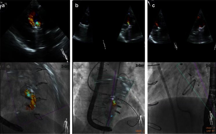 Fig. 12