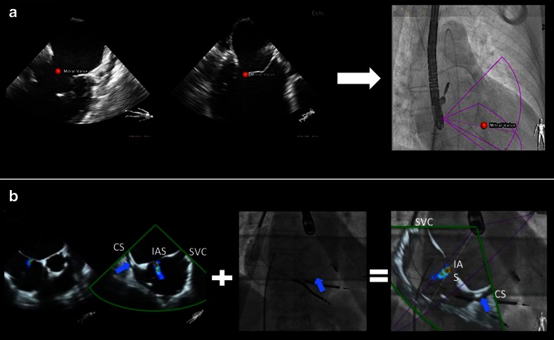 Fig. 4